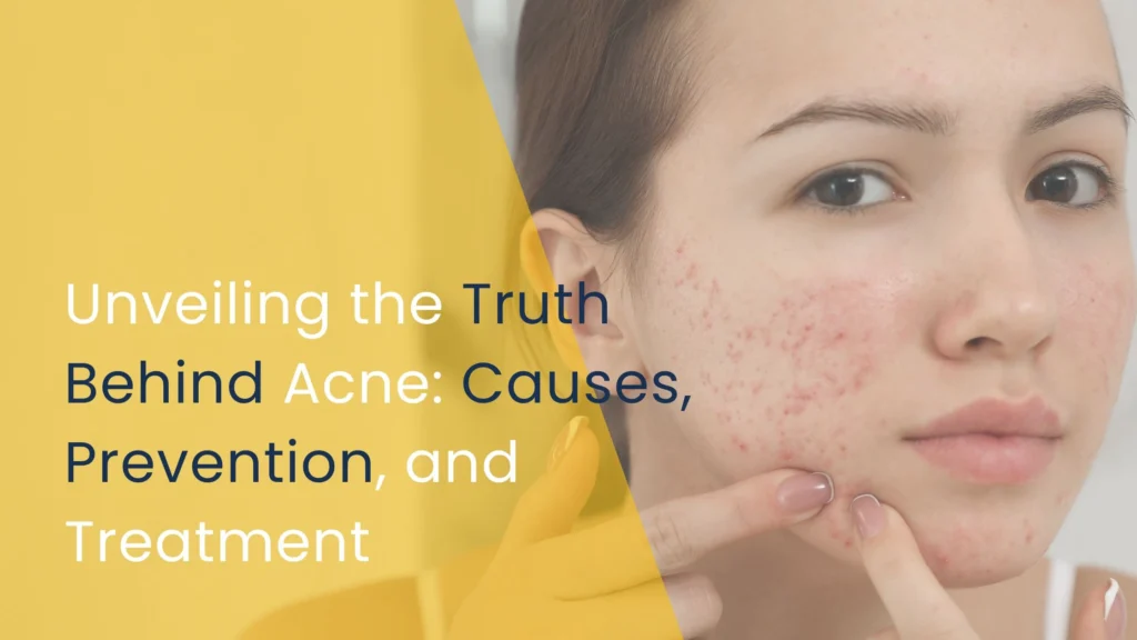 Unveiling the Truth Behind Acne_ Causes, Prevention, and Treatment
